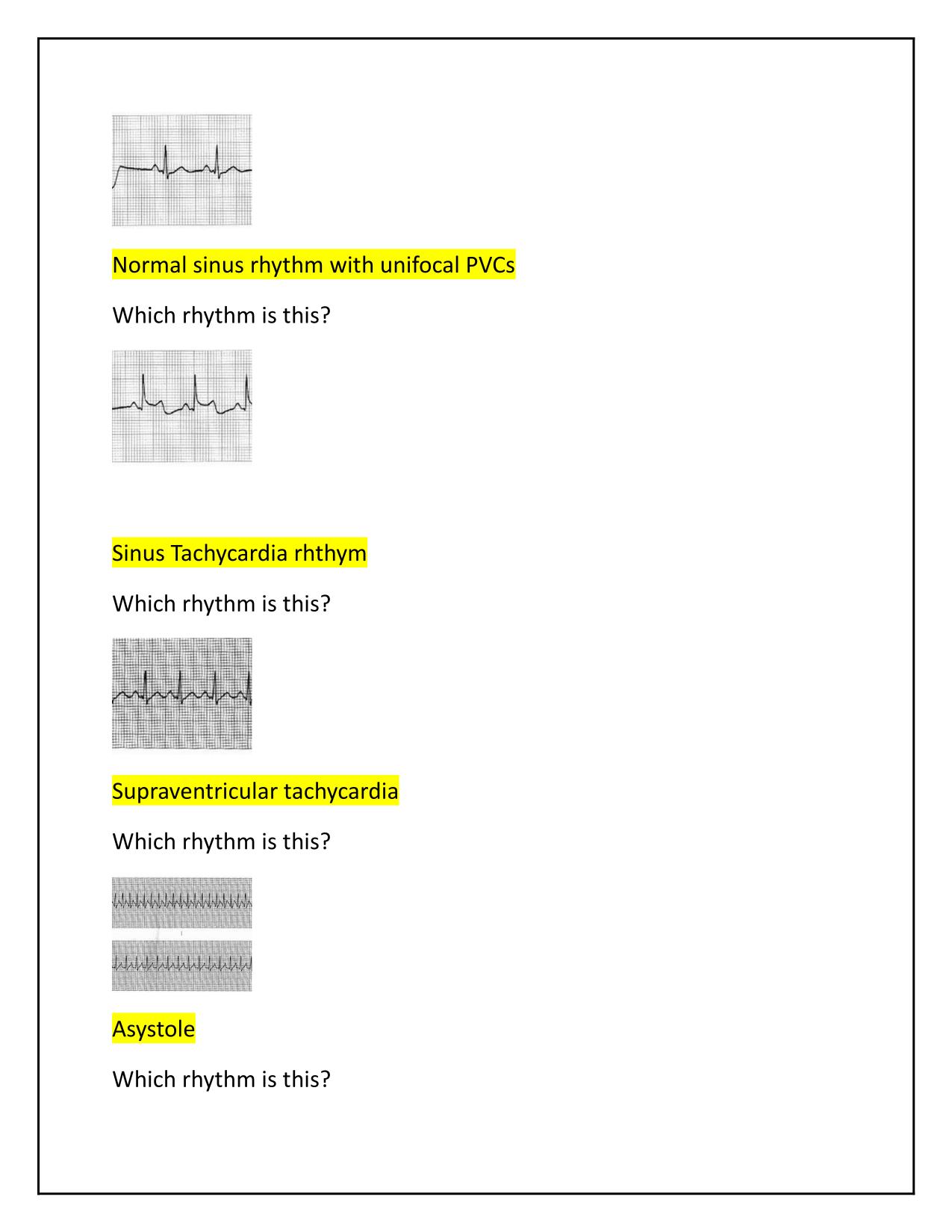 Nursing EKG Questions and Correct Answers Latest 2025