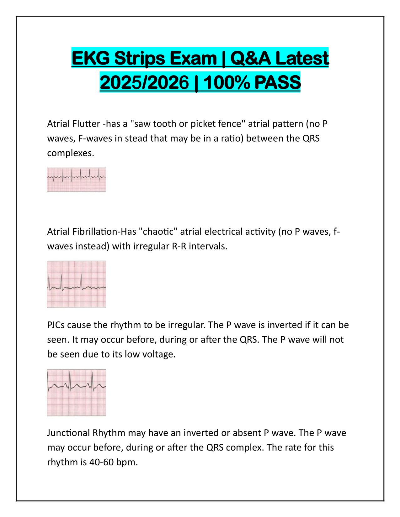 EKG Strips Exam Q&A Latest Update