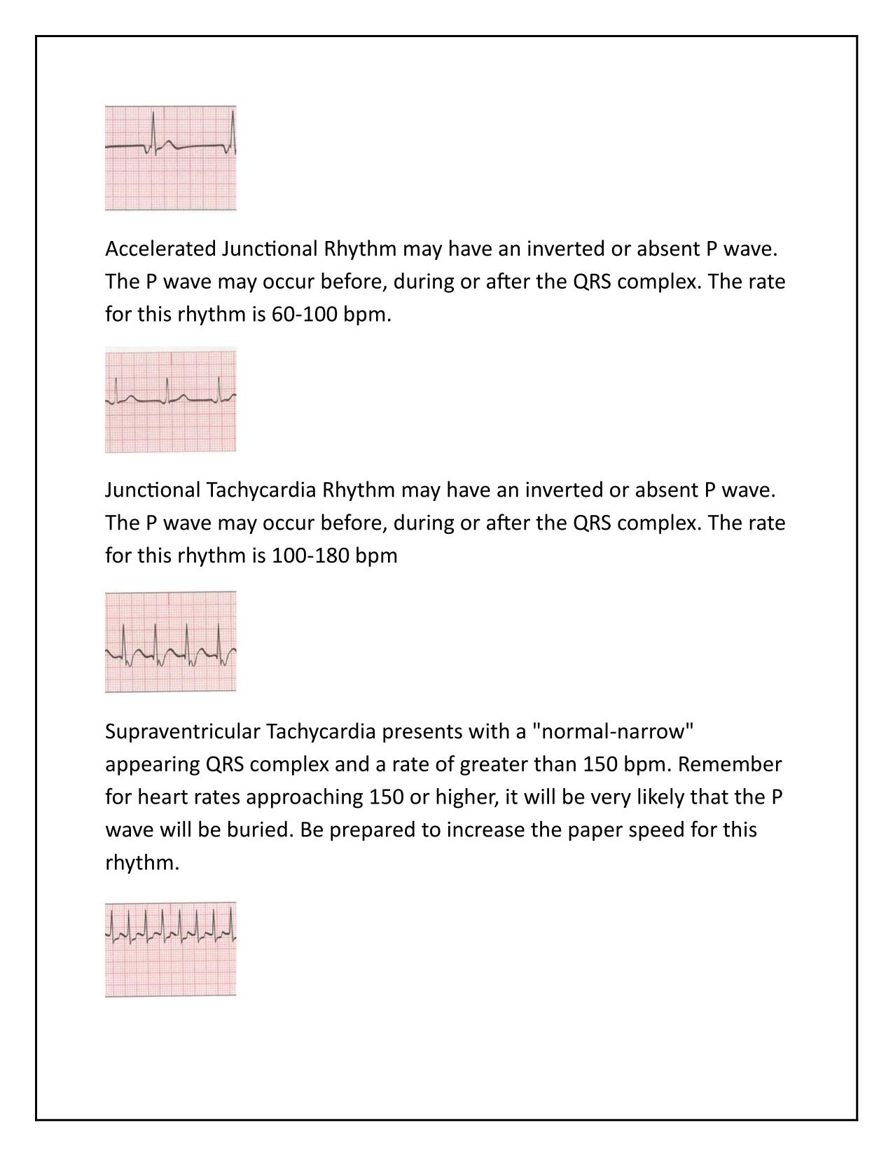 EKG Strips Exam Q&A Latest Update