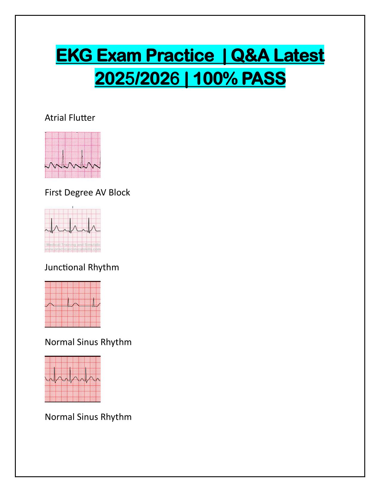 EKG Exam Practice Q&A Latest Update 2025
