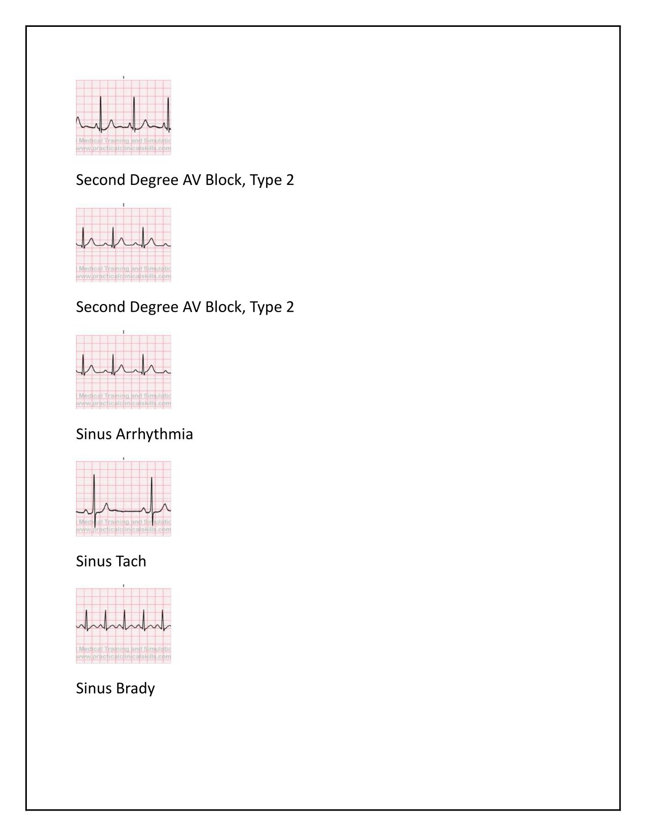 EKG Exam Practice Q&A Latest Update 2025